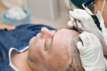 Master Certification in Hair Transplant (FUE)